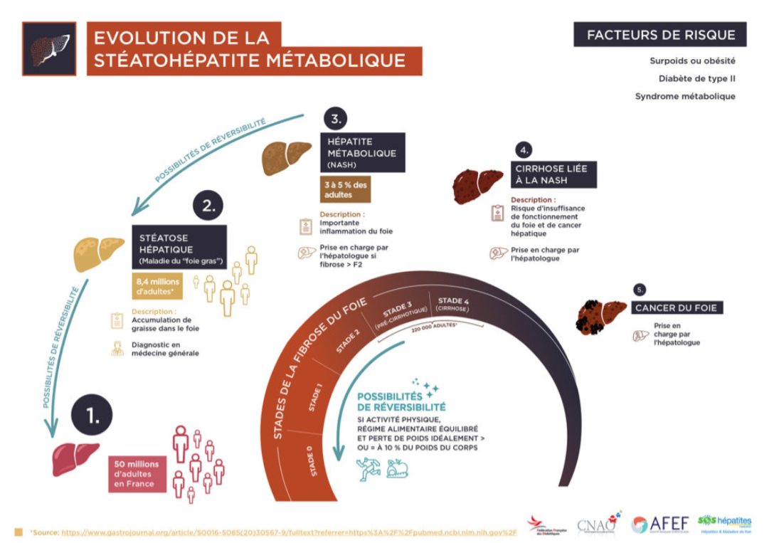 Evolution de la stéatose hépatite